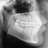 Radiologia Odontológica em Divinópolis